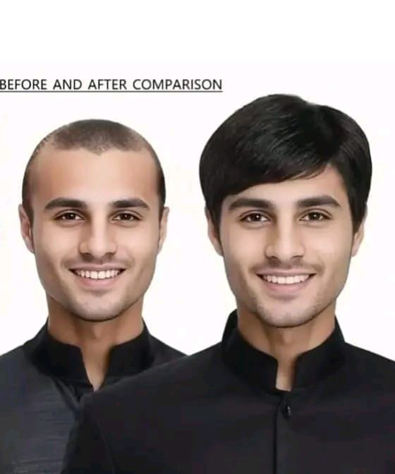 Mans  skin base article