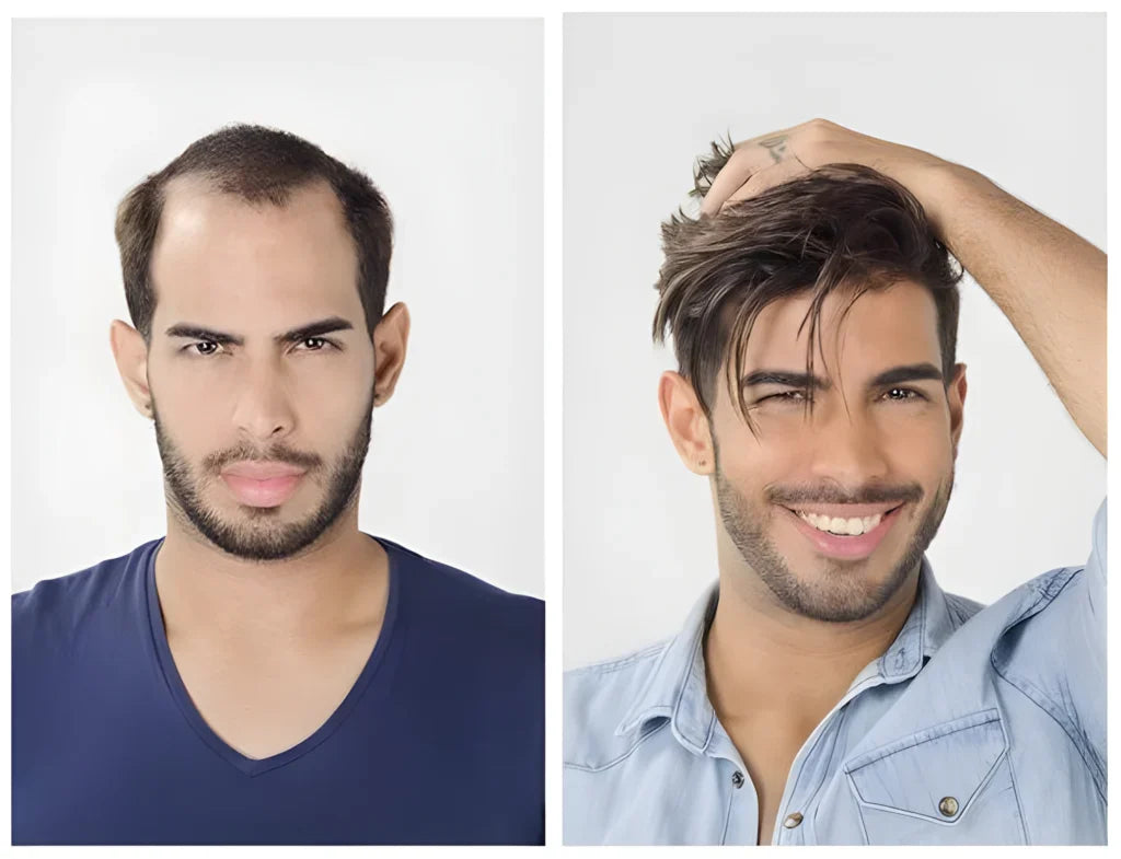 USA Fine Mono Hair Replacement System Hair Unit